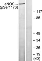 eNOS (phospho Ser1177) Polyclonal Antibody