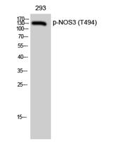 eNOS (phospho Thr494) Polyclonal Antibody