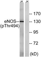 eNOS (phospho Thr494) Polyclonal Antibody