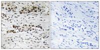 ERα (phospho Ser102) Polyclonal Antibody