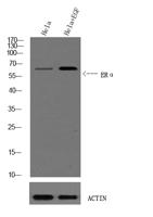 ERα (phospho Ser102) Polyclonal Antibody