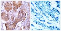 ERα (phospho Ser106) Polyclonal Antibody