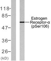 ERα (phospho Ser106) Polyclonal Antibody