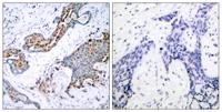 ERα (phospho Ser118) Polyclonal Antibody