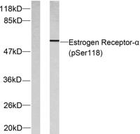 ERα (phospho Ser118) Polyclonal Antibody