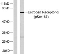 ERα (phospho Ser167) Polyclonal Antibody