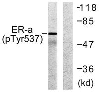 ERα (phospho Tyr537) Polyclonal Antibody