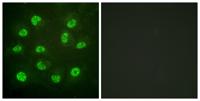 ERβ (phospho Ser105) Polyclonal Antibody