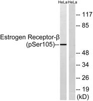 ERβ (phospho Ser105) Polyclonal Antibody