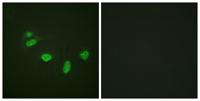 Ets-1 (phospho Thr38) Polyclonal Antibody