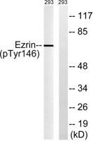 Ezrin (phospho Tyr146) Polyclonal Antibody