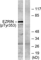 Ezrin (phospho Tyr353) Polyclonal Antibody