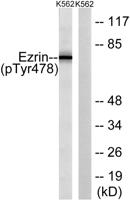 Ezrin (phospho Tyr478) Polyclonal Antibody