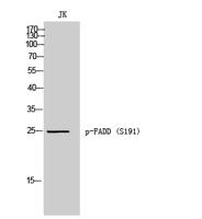 FADD (phospho Ser191) Polyclonal Antibody