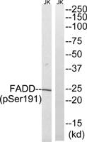 FADD (phospho Ser191) Polyclonal Antibody