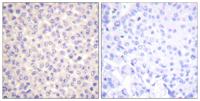 FADD (phospho Ser194) Polyclonal Antibody