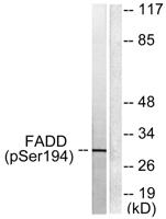 FADD (phospho Ser194) Polyclonal Antibody