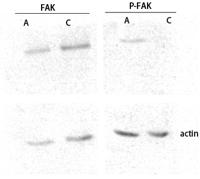 FAK (phospho Ser843) Polyclonal Antibody