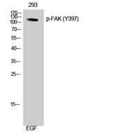 FAK (phospho Tyr397) Polyclonal Antibody