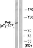 FAK (phospho Tyr397) Polyclonal Antibody