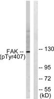 FAK (phospho Tyr407) Polyclonal Antibody