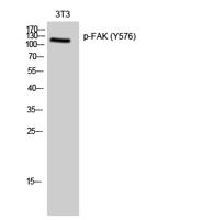 FAK (phospho Tyr576) Polyclonal Antibody