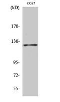 FAK (phospho Tyr861) Polyclonal Antibody