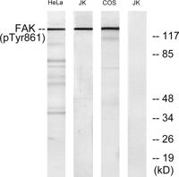 FAK (phospho Tyr861) Polyclonal Antibody