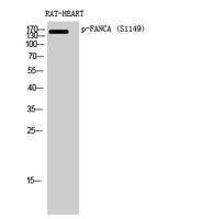 FANCA (phospho Ser1149) Polyclonal Antibody