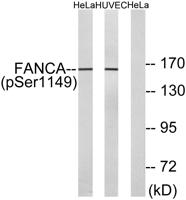 FANCA (phospho Ser1149) Polyclonal Antibody