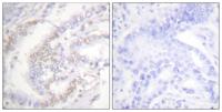 FANCD2 (phospho Ser222) Polyclonal Antibody