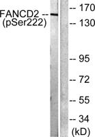 FANCD2 (phospho Ser222) Polyclonal Antibody