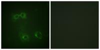 FAS (phospho Tyr291) Polyclonal Antibody