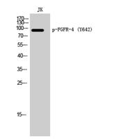 FGFR-4 (phospho Tyr642) Polyclonal Antibody