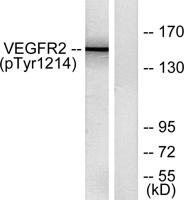 Flk-1/VEGFR2 (phospho Tyr1214) Polyclonal Antibody