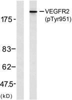 Flk-1/VEGFR2 (phospho Tyr951) Polyclonal Antibody