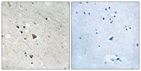 Flt-3 (phospho Tyr969) Polyclonal Antibody