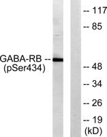 GABAA Rβ1 (phospho Ser434) Polyclonal Antibody