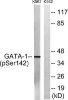 GATA-1 (phospho Ser142) Polyclonal Antibody