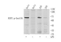 RIP2 (phospho Ser176) Polyclonal Antibody