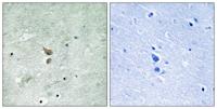 RIP2 (phospho Ser176) Polyclonal Antibody