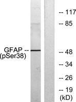 GFAP (phospho Ser38) Polyclonal Antibody