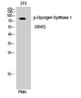 Glycogen Synthase 1 (phospho Ser645) Polyclonal Antibody