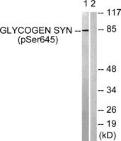 Glycogen Synthase 1 (phospho Ser645) Polyclonal Antibody