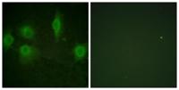 IL-9R (phospho Ser519) Polyclonal Antibody