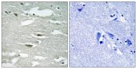 ILK (phospho Ser246) Polyclonal Antibody