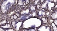 Insulin R (phospho Thr1375) Polyclonal Antibody