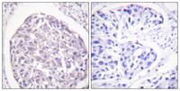 Insulin R (phospho Tyr1355) Polyclonal Antibody