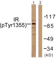 Insulin R (phospho Tyr1355) Polyclonal Antibody