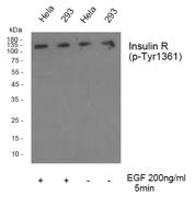 Insulin R (phospho Tyr1361) Polyclonal Antibody